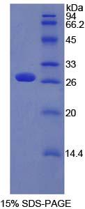 PTCH1 / Patched 1 Protein - Recombinant Patched 1 By SDS-PAGE