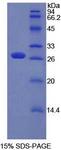 PTCH1 / Patched 1 Protein - Recombinant Patched 1 By SDS-PAGE