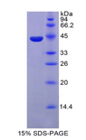 PTH / Parathyroid Hormone Protein - Recombinant Parathyroid Hormone By SDS-PAGE