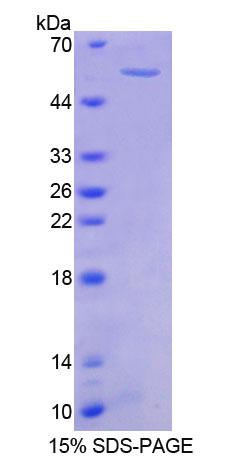 PTK2B / PYK2 Protein - Recombinant  Protein Tyrosine Kinase 2 Beta By SDS-PAGE