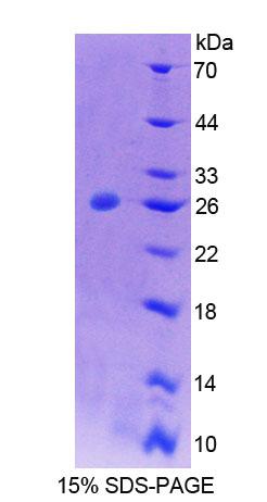 PTPN21 / PTPD1 Protein - Recombinant Protein Tyrosine Phosphatase, Non Receptor Type 21 (PTPN21) by SDS-PAGE