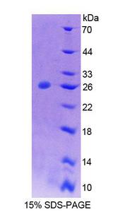 PTPN21 / PTPD1 Protein - Recombinant Protein Tyrosine Phosphatase, Non Receptor Type 21 (PTPN21) by SDS-PAGE