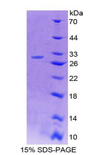 PTPRH / SAP-1 Protein - Recombinant Protein Tyrosine Phosphatase Receptor Type H By SDS-PAGE