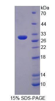 PTPRN2 / Phogrin Protein - Recombinant Protein Tyrosine Phosphatase Receptor Type N2 (PTPRN2) by SDS-PAGE