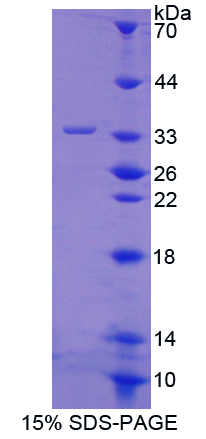PTPRO Protein - Recombinant  Protein Tyrosine Phosphatase Receptor Type O By SDS-PAGE