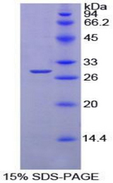 PTPRS Protein - Recombinant Protein Tyrosine Phosphatase Receptor Type S By SDS-PAGE
