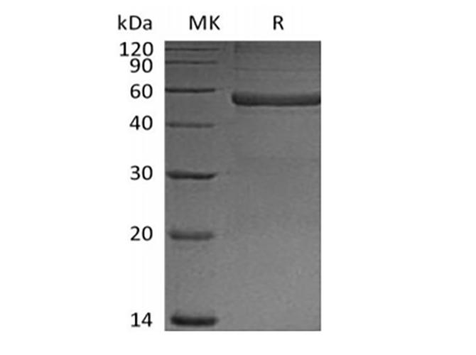 PTX3 / Pentraxin 3 Protein - Recombinant Mouse Pentraxin-related protein PTX3(N-6His)