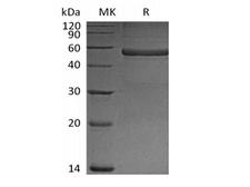 PTX3 / Pentraxin 3 Protein - Recombinant Mouse Pentraxin-related protein PTX3(N-6His)