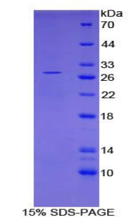PVRL2 / CD112 Protein - Recombinant Poliovirus Receptor Related Protein 2 By SDS-PAGE