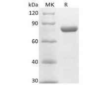 PVRL4 / Nectin 4 Protein - Recombinant Mouse Nectin-4 (C-Fc)