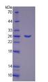 PYGM Protein - Recombinant Glycogen Phosphorylase, Muscle By SDS-PAGE