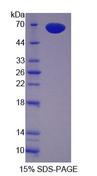 PZP Protein - Recombinant Pregnancy Zone Protein By SDS-PAGE