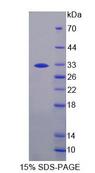PZP Protein - Recombinant  Pregnancy Zone Protein By SDS-PAGE