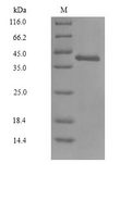 QPCT / QC Protein - (Tris-Glycine gel) Discontinuous SDS-PAGE (reduced) with 5% enrichment gel and 15% separation gel.
