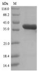 QPCT / QC Protein - (Tris-Glycine gel) Discontinuous SDS-PAGE (reduced) with 5% enrichment gel and 15% separation gel.