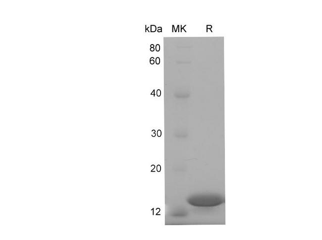 RBP1 / CRBP Protein - Recombinant Mouse RBP1 Protein (His Tag)-Elabsicence