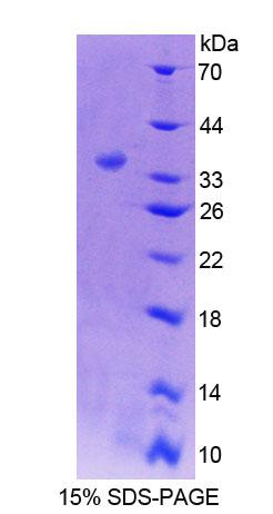 RCAN2 / RCN2 Protein - Recombinant  Reticulocalbin 2 By SDS-PAGE