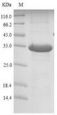 Reg1 Protein - (Tris-Glycine gel) Discontinuous SDS-PAGE (reduced) with 5% enrichment gel and 15% separation gel.