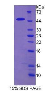 REG1A Protein - Recombinant  Regenerating Islet Derived Protein 1 Alpha By SDS-PAGE