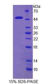 REG1A Protein - Recombinant  Regenerating Islet Derived Protein 1 Alpha By SDS-PAGE