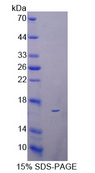 Reg3b Protein - Recombinant  Regenerating Islet Derived Protein 3 Beta By SDS-PAGE