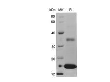 REG4 / REG-IV Protein - Recombinant Mouse REG4 Protein (His Tag)-Elabscience