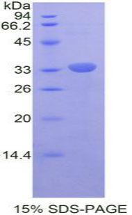 RELB Protein - Recombinant V-Rel Reticuloendotheliosis Viral Oncogene Homolog B By SDS-PAGE