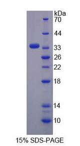 REPIN1 Protein - Recombinant Replication Initiator 1 By SDS-PAGE