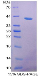 RETNLB / RELM-Beta Protein - Recombinant Resistin Like Beta By SDS-PAGE