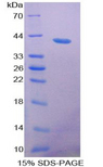 RETNLB / RELM-Beta Protein - Recombinant Resistin Like Beta By SDS-PAGE