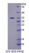 RFC2 / RFC40 Protein - Recombinant Replication Factor C2 (RFC2) by SDS-PAGE