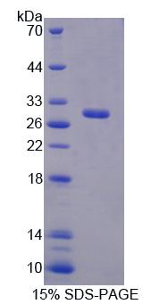 RFC4 Protein - Recombinant Replication Factor C4 (RFC4) by SDS-PAGE