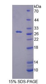 RFC5 Protein - Recombinant Replication Factor C5 (RFC5) by SDS-PAGE