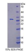 RFC5 Protein - Recombinant Replication Factor C5 (RFC5) by SDS-PAGE