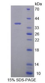 RGN / Regucalcin Protein - Recombinant Regucalcin By SDS-PAGE