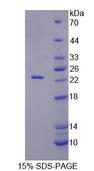 RGS10 Protein - Recombinant Regulator Of G Protein Signaling 10 (RGS10) by SDS-PAGE