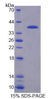 RGS9 Protein - Recombinant Regulator Of G Protein Signaling 9 (RGS9) by SDS-PAGE