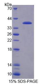 RGS9 Protein - Recombinant Regulator Of G Protein Signaling 9 (RGS9) by SDS-PAGE