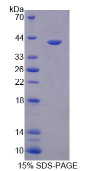 Rhodanese / TST Protein - Recombinant Thiosulfate Sulfurtransferase By SDS-PAGE
