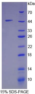 Ribonuclease A / RNASE1 Protein - Recombinant Ribonuclease A By SDS-PAGE