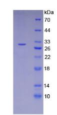 RIPK3 / RIP3 Protein - Recombinant Receptor Interacting Serine Threonine Kinase 3 By SDS-PAGE