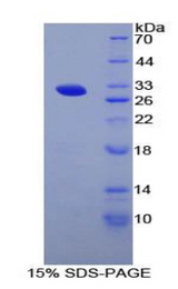 RNPEP Protein - Recombinant Arginyl Aminopeptidase By SDS-PAGE