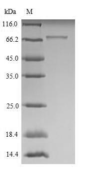 ROBO1 Protein - (Tris-Glycine gel) Discontinuous SDS-PAGE (reduced) with 5% enrichment gel and 15% separation gel.