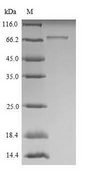 ROBO1 Protein - (Tris-Glycine gel) Discontinuous SDS-PAGE (reduced) with 5% enrichment gel and 15% separation gel.