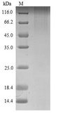 ROBO1 Protein - (Tris-Glycine gel) Discontinuous SDS-PAGE (reduced) with 5% enrichment gel and 15% separation gel.
