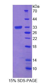 ROM1 Protein - Recombinant Retinal Outer Segment Membrane Protein 1 (ROM1) by SDS-PAGE