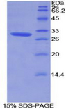 ROR1 Protein - Recombinant Receptor Tyrosine Kinase Like Orphan Receptor 1 By SDS-PAGE