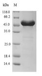 RPLP0 Protein - (Tris-Glycine gel) Discontinuous SDS-PAGE (reduced) with 5% enrichment gel and 15% separation gel.