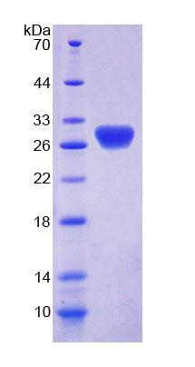 RTBDN / Retbindin Protein - Recombinant  Retbindin By SDS-PAGE