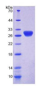 RTBDN / Retbindin Protein - Recombinant  Retbindin By SDS-PAGE